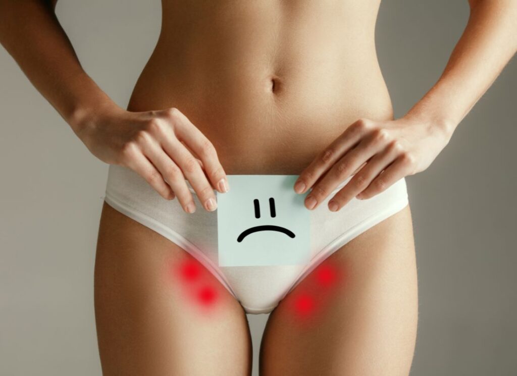 prikaz problema na koži prilikom nošenja donjeg veša od sintetike